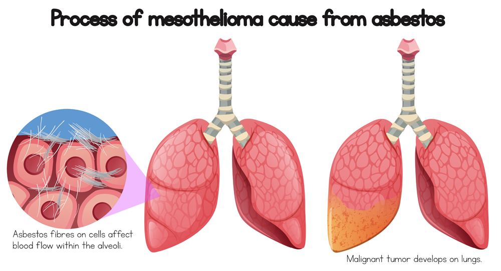 The dangers of asbestos